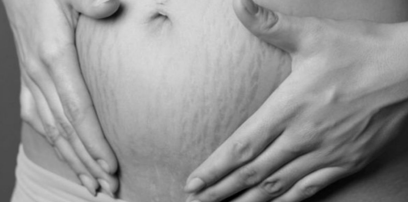 Realistic Post-Pregnancy Body Expectations