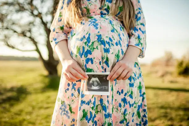 How to Choose Maternity Shoot Dresses That Flatter Your Bump